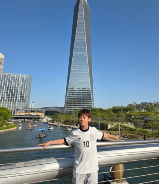 이수진 이동국 아들 부상